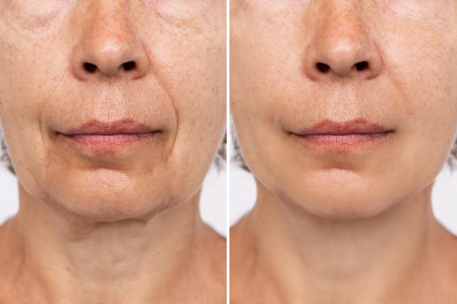 Relato visual Nova Beauty Sérum 3