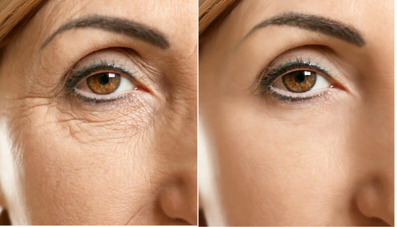 Relato visual Nova Beauty Sérum 6