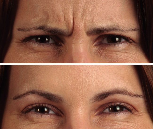 Relato visual Nova Beauty Sérum 7