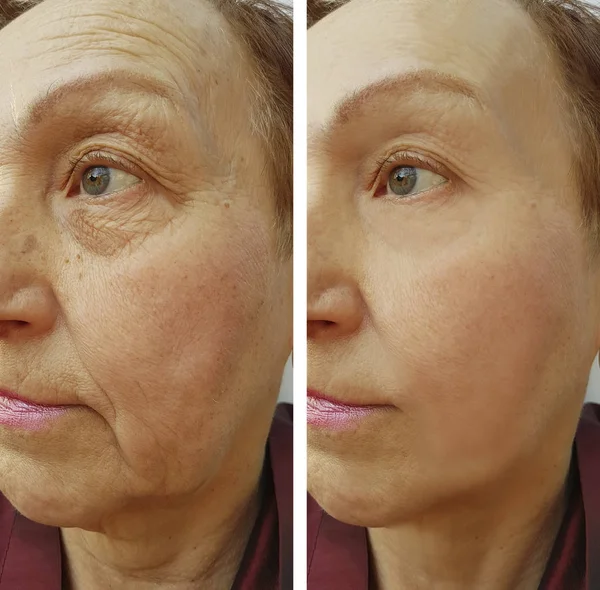 Relato visual Nova Beauty Sérum 8